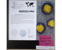 Hepatitis C VIRUS